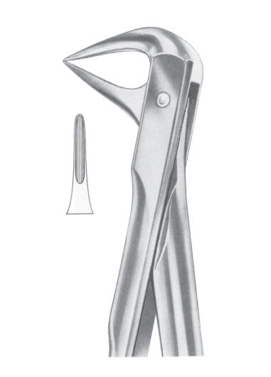 Fig. 74XN lower roots and crowded incisors